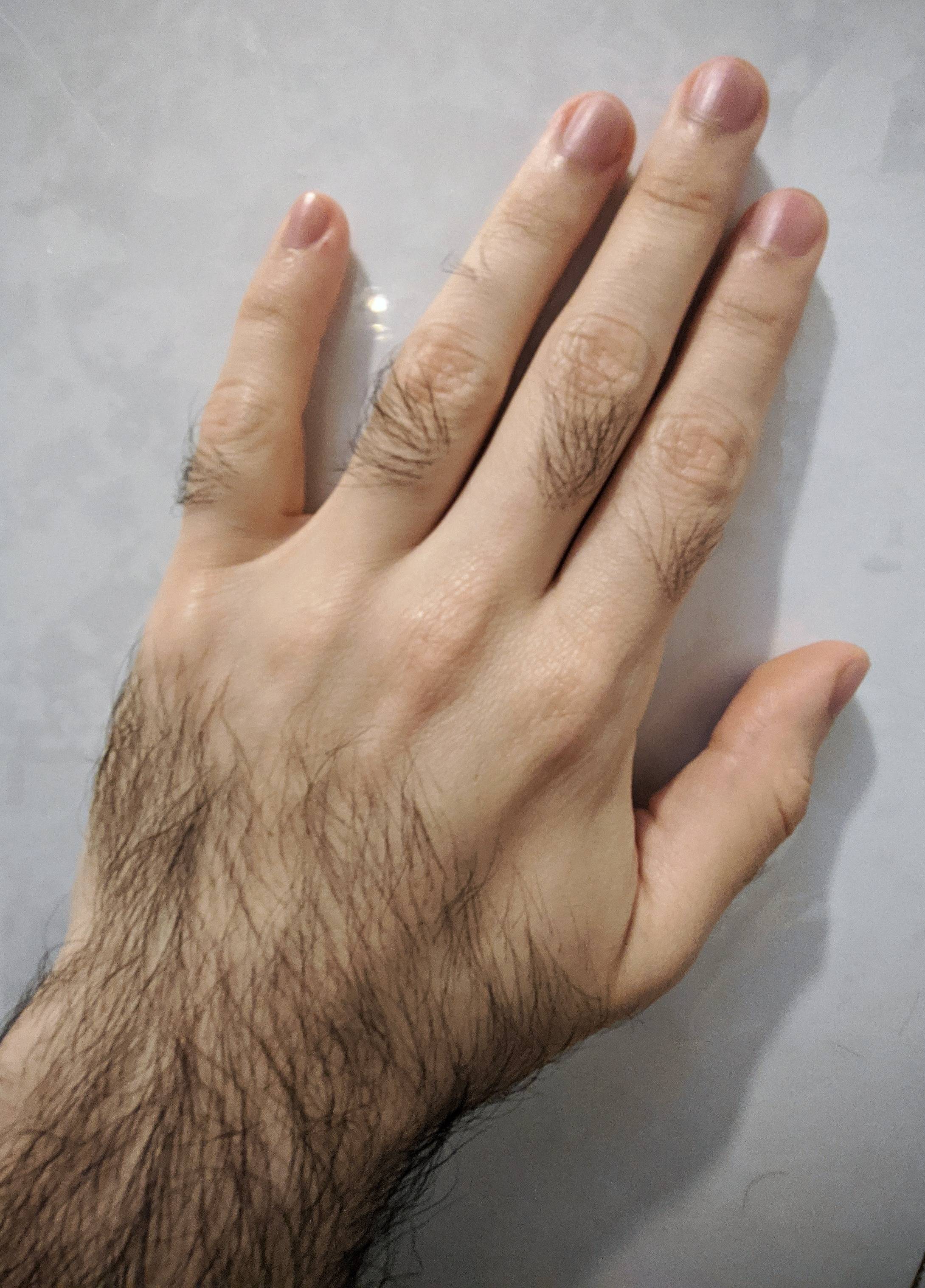 Hairy knuckles